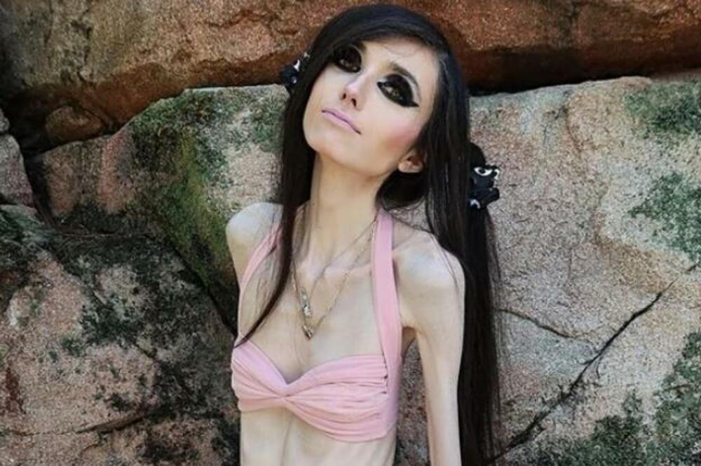 ŠOKANTNI SNIMCI NAJMRŠAVIJE DEVOJKE NA SVETU: Za nju kažu da je ŽIVI KOSTUR, ljudima je GADNO da GLEDAJU OVO