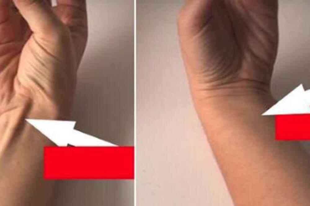 DODIRNITE MALI PRST PALCEM I SAZNAĆETE VELIKU ISITNU: Ako nemate OVAJ MIŠIĆ, spadate u 10-15 odsto ljudi NA SVETU