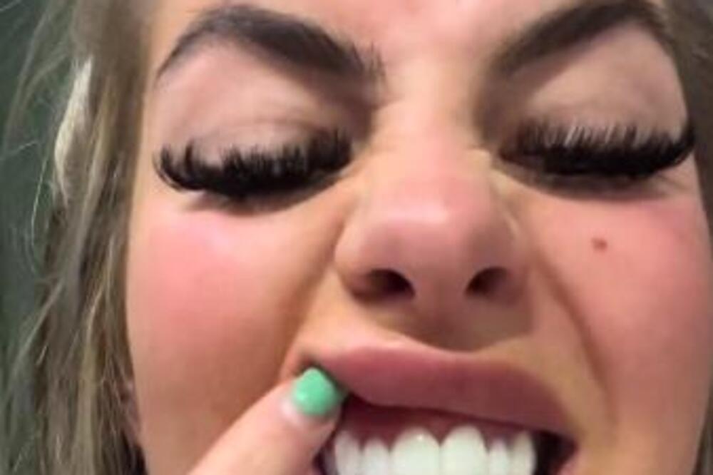 OTIŠLA U TURSKU I DALA VELIKE PARE, A DOKTORI JE UNIŠTILI: Ljudi NE VERUJU šta vide, svi je OSUĐUJU (VIDEO)