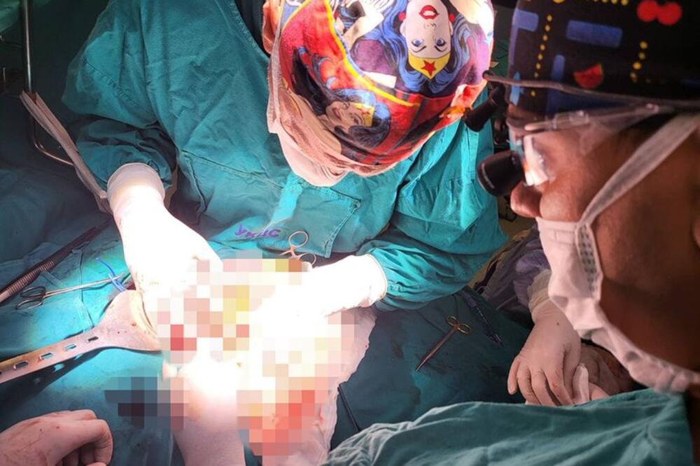 PODVIG SRPSKIH LEKARA! U Kliničkom centru prvi put izvedena operacija raka pankreasa koja se radi MALO GDE U SVETU!