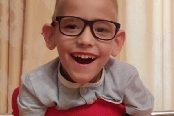 MALENI VUK IMA CEREBRALNU PARALIZU, SRBIJO, PROBUDI SE: Pomozimo mu slanjem 98 na 2407