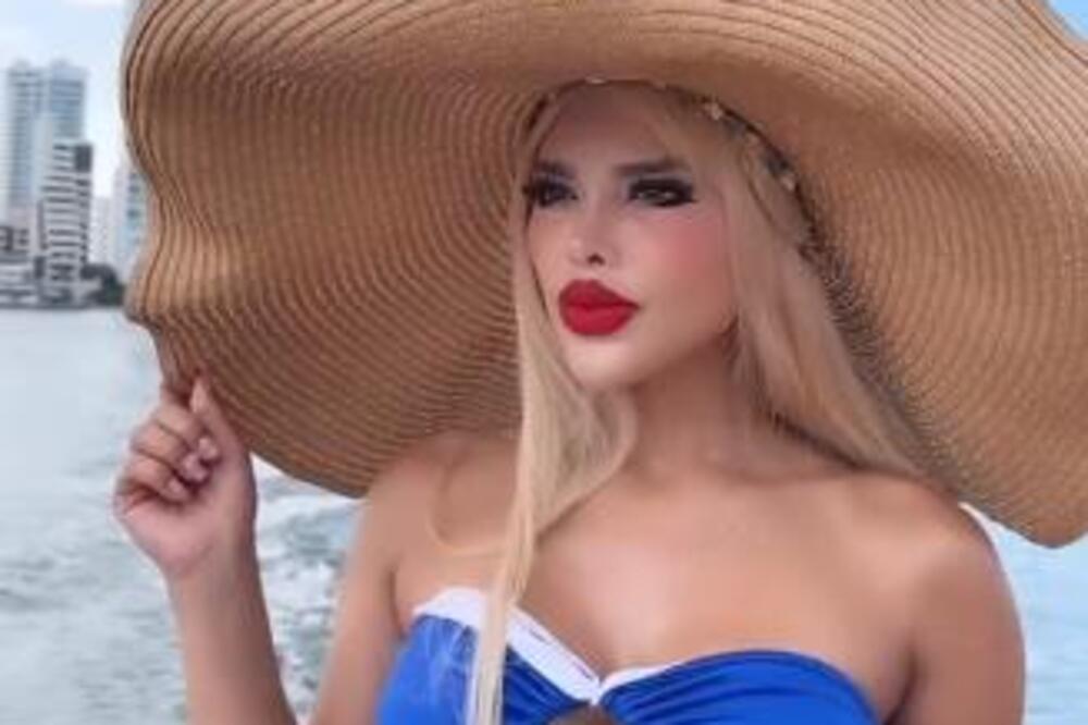 'ŽIVA BARBIKA' JE PRVU OPERACIJU IMALA SA SAMO 11 GODINA: Do sada ih je uradila 29, a razlog za to je JEZIV (VIDEO)