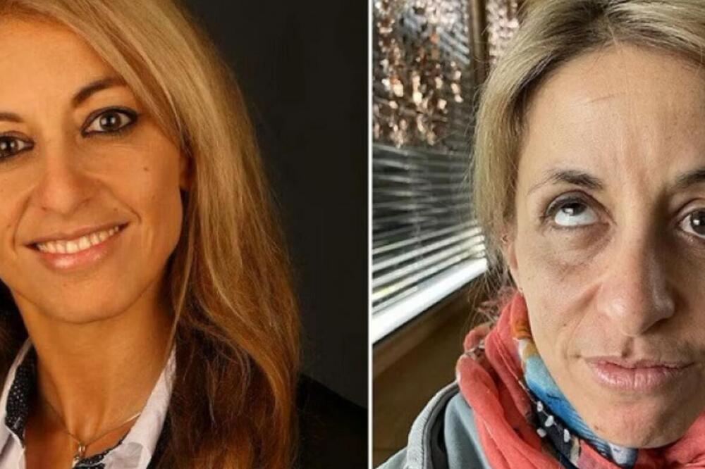 PRELEPOJ ŽENI LEKAR NA RUTINSKOJ OPERACIJI UPROPASTIO ŽIVOT: Unakazio je da ne može OČI da OTVORI