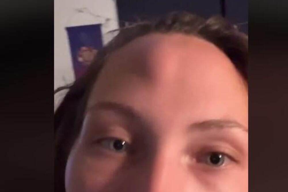 EMI SE NA ČELU IZNENADA POJAVILA KVRGA A UJUTRU JOJ SE DESILO NOVO ČUDO: Doktori su bili ZBUNJENI, niko nma ODGOVOR