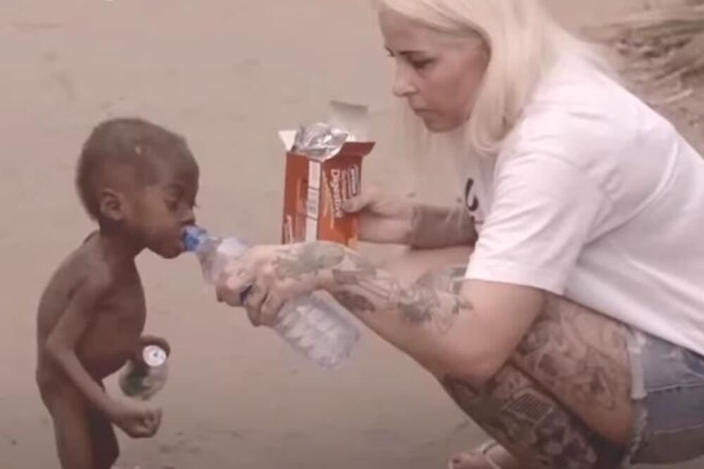 EVO KAKO DANAS IZGLEDA DEČAK ČIJE SU SLIKE ZAPANJILE SVET: Roditelji ga ostavili da UMRE U MUKAMA, a sada.. (FOTO)