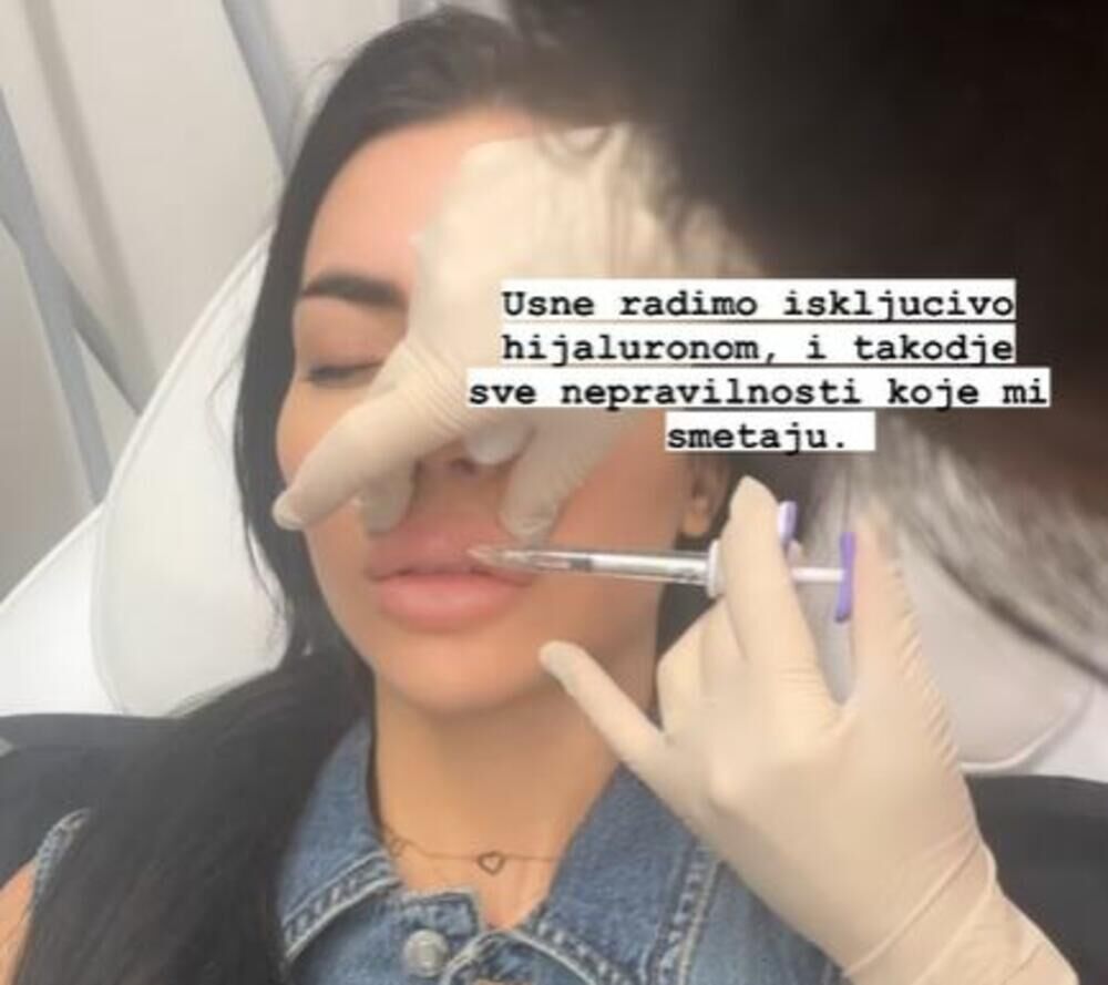 Sada je poradila i na svom licu i otišla na remont kako bi uklonila sve nedostatke koje smatra da ima
