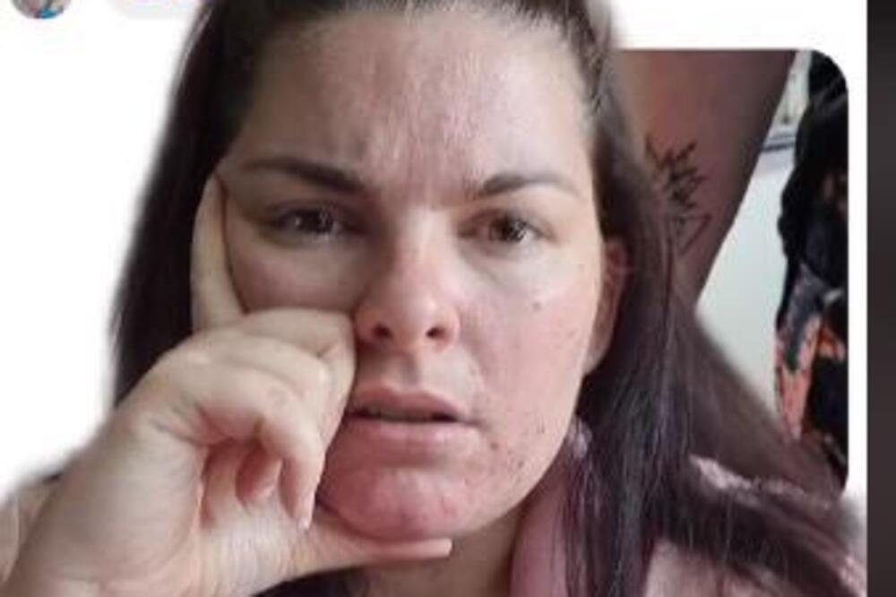 ISTETOVIRALA JE ANANAS NA RUCI, PA SAZNALA ZA NJEGOVO DVOSTRUKO ZNAČENJE: Nije mogla da dođe sebi OD ŠOKA