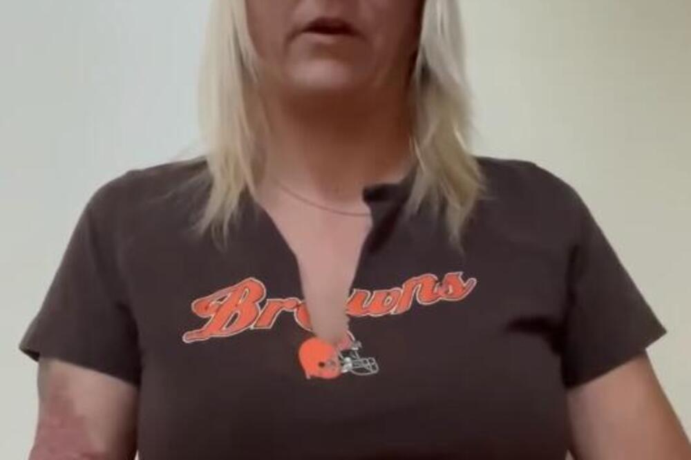 ŽENA SEDELA SA SVOJIM PRIJATELJEM, A ONDA SE NA NJIH ZALETEO PAS: Pomahnitala životinja pokušala da je ŽIVU POJEDE