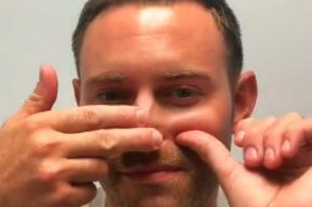 DOKTOR POKAZAO KAKO DA OTPUŠITE NOS ZA 15 SEKUNDI: Ne kupujte KAPI, one stvara ZAVISNOST i štete SLUZOKOŽI