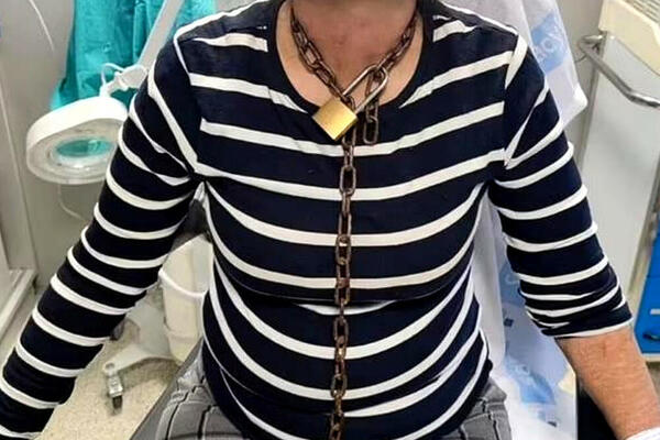 ŽENA UŠLA U BOLNICU SA LANCEM OKO VRATA: U jezivom ISKAZU ispričala kako se našla u OVOJ SITUACIJI, lekari u ŠOKU!