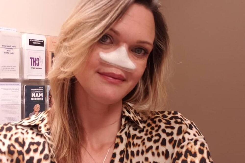 OVOJ ŽENI SU ODSTRANILI NOS IZ JEZIVOG RAZLOGA: Umesto njega ima VELIKU ŠUPLJINU, sad ponosno POKAZUJE KAKO IZGLEDA