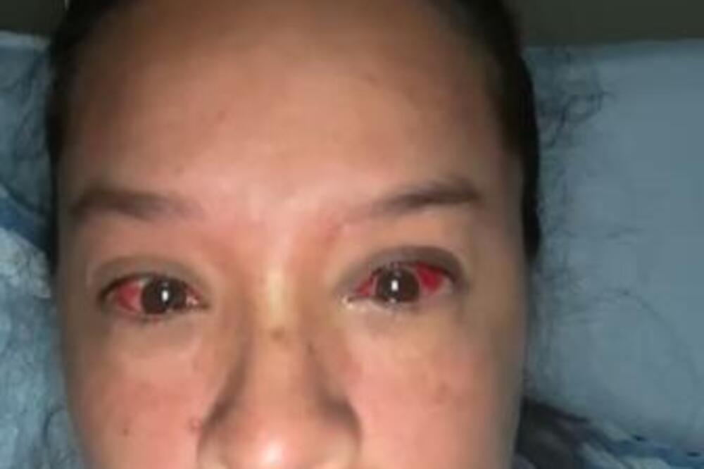 KRV JOJ JE LILA IZ OČIJU ZBOG OVE GREŠKE: Znala je da to NIKAKO ne sme da radi, ali nije bilo IZBORA...(VIDEO)