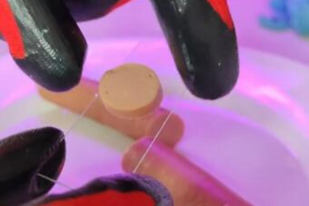 DA LI STE VIDELI SNIMAK "IZGLEDA" VIRŠLE POD MIKROSKOPOM? U pitanju je lažan video