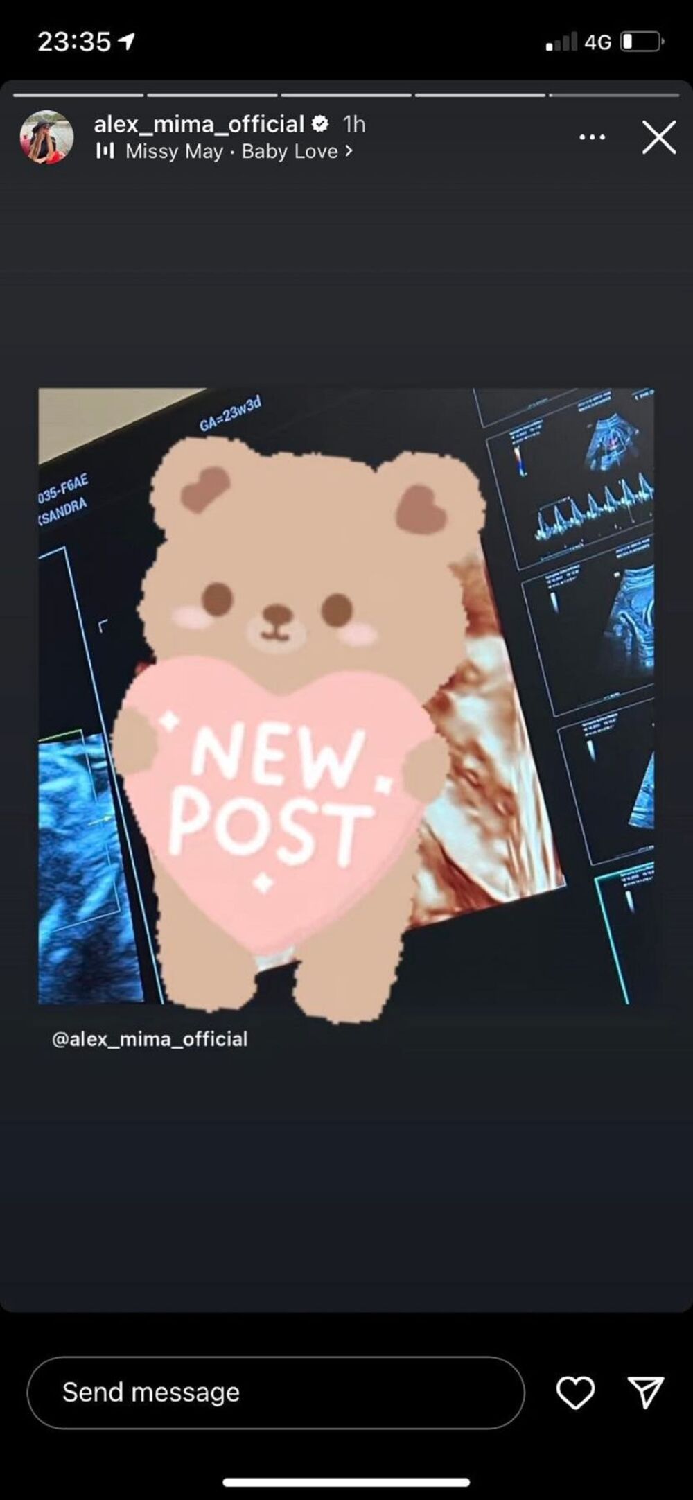 Aleks čeka dete sa partnerom kog je upoznala u 'Zadruzi'