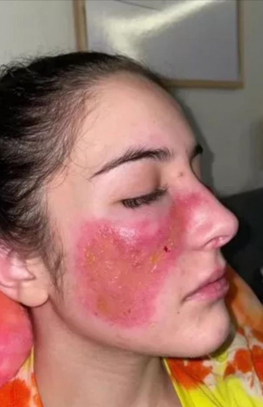 Devojka alergična sama na sebe, Bet Tsangarides