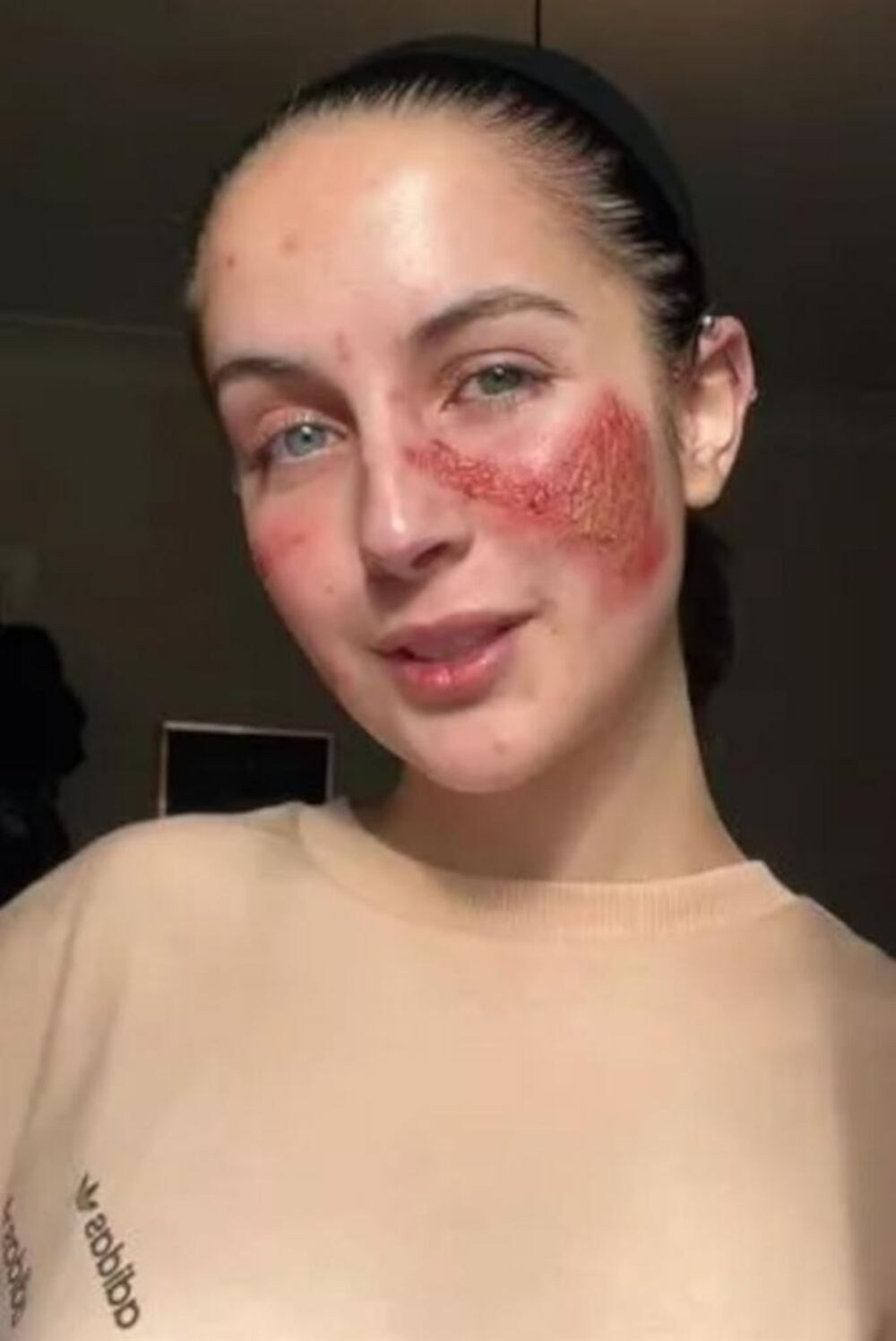 Devojka alergična sama na sebe, Bet Tsangarides