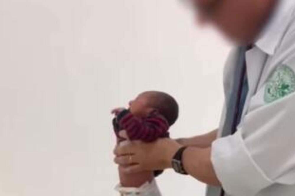 ŠTA JE, BRE OVO? Tek rođena beba ŠOKIRALA sve odreda, doktori ZANEMELI...18 miliona ljudi gleda i NE TREPĆE (VIDEO)