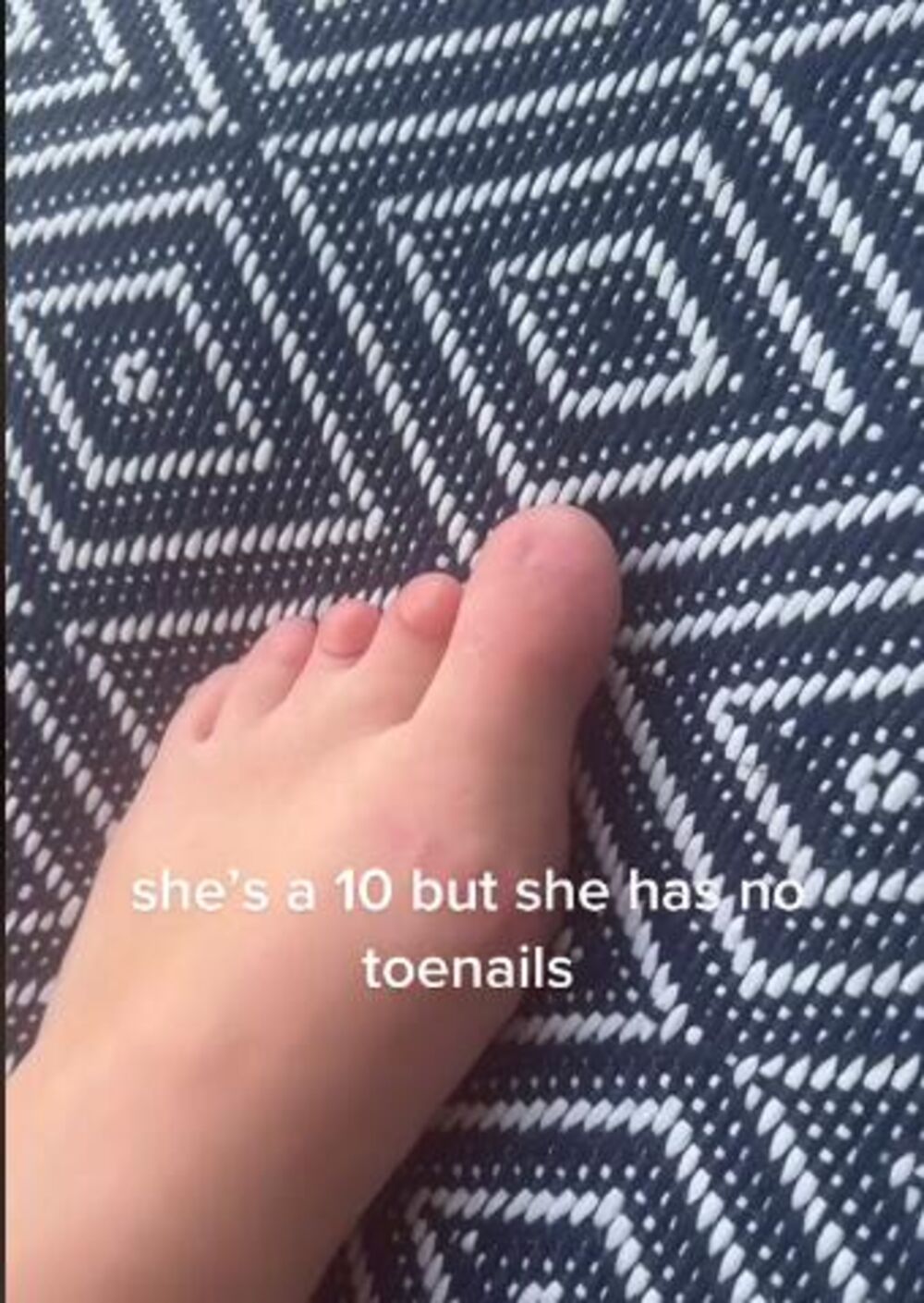 Tinejdžerka rođena bez noktiju na nogama