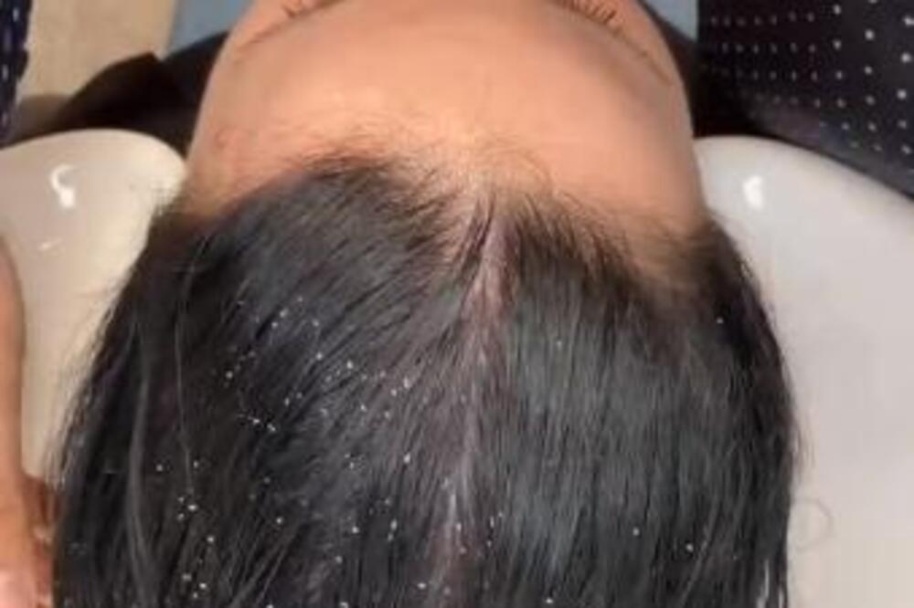 STRUČNJACI SMATRAJU DA JE OVO KLJUČNI RAZLOG OPADANJA KOSE KOD ŽENA: Kada ga čujete sve će vam biti JASNO