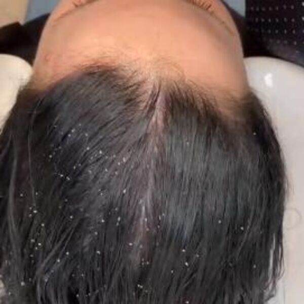 NAJBOLJE PRIRODNO SREDSTVO ZA ISPUCALE KRAJEVE KOSE: Ne košta NIŠTA, a savršena je zamena za skupu hemiju