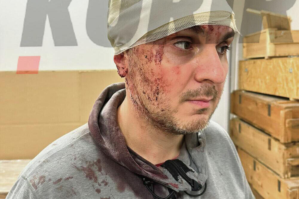 DOKTOR KAJTAZI PUŠTEN IZ URGENTNOG NA KUĆNO LEČENJE: Proveo 24 sata na intenzivnoj nakon STRAVIČNOG NAPADA