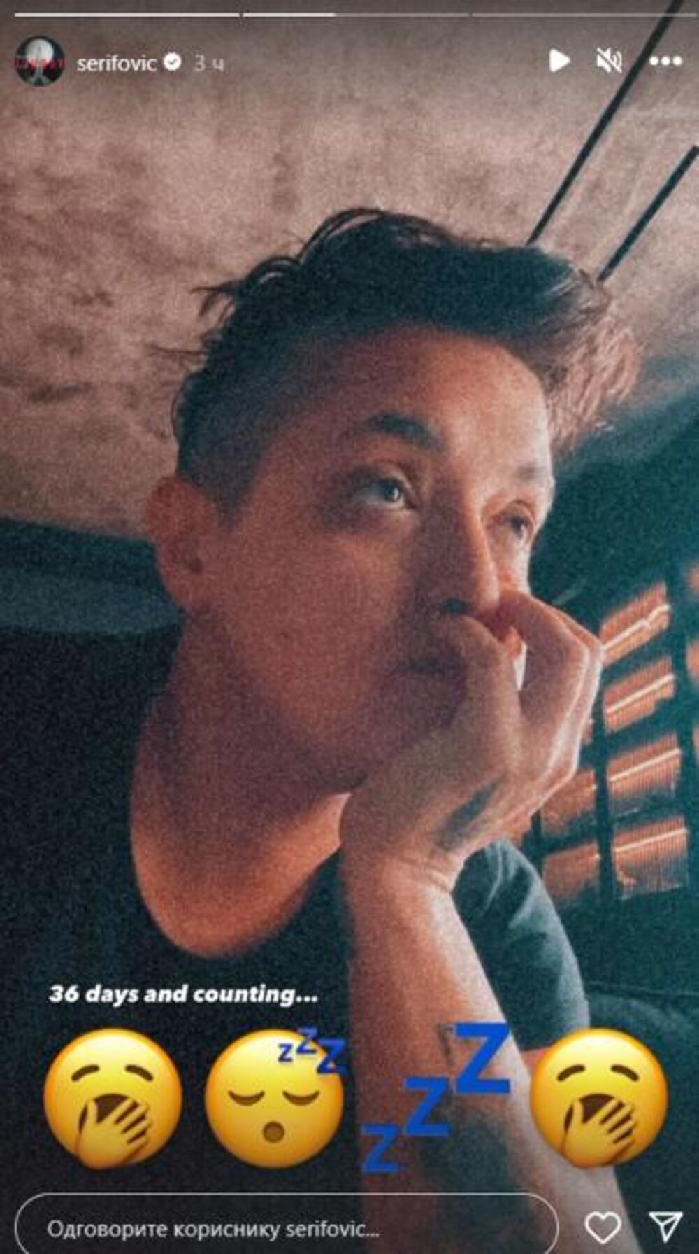 Pevačica pokazala podočnjake 