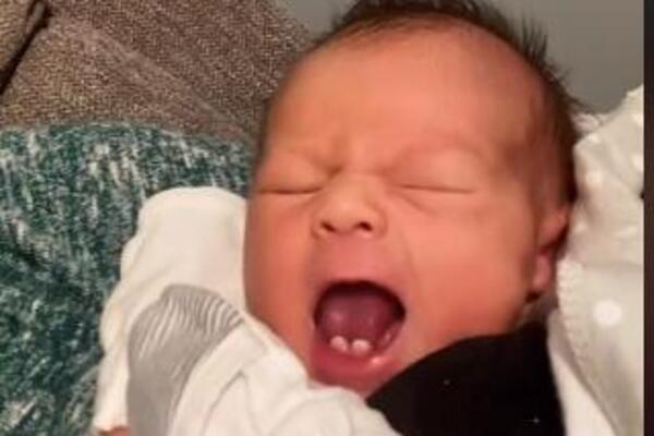 OVA BEBA JE ROĐENA SA NEČIM ŠTO POČNE DA RASTE TEK U 6. GODINI: Čitava BOLNICA je bila u NEVERICI kad je VIDELA