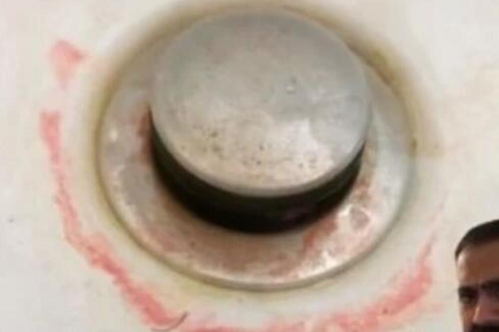 AKO VIDITE OVO U UMIVAONIKU I POD TUŠEM ODMAH URADITE DEZINFEKCIJU: Doktor tvrdi da nije PRLJAVŠTINA već mnogo GORE