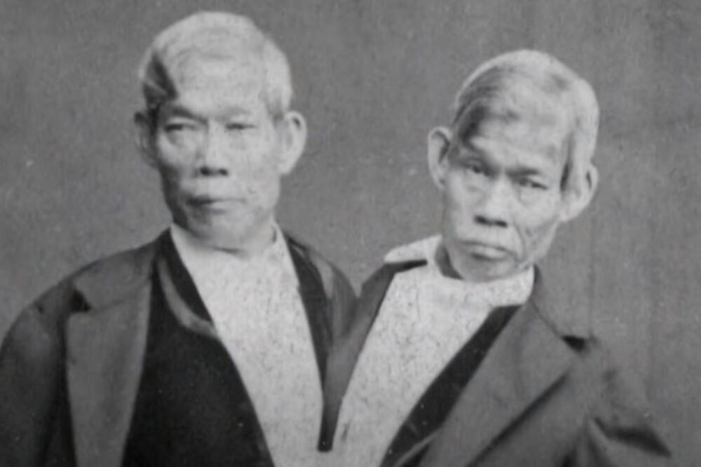 PRVI SIJAMSKI BLIZANCI IMALI NAJNORMALNIJE ODNOSE, NIKOME NIJE JASNO KAKO: Živeli SREĆAN život i UMRLI istog dana