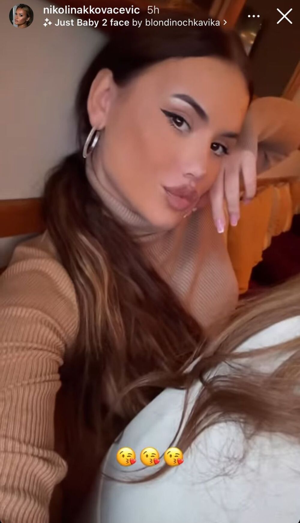 Srpska influenserka 20 dana posle operacije promene pola, pokazala kako izgleda