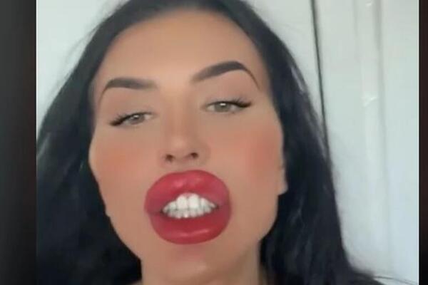 ČUVENA MANEKENKA KOJU CEO SVET ZNA UPROPASTILA SE PLASTIČNIM OPERACIJAMA: Da li je moguće da sada ovako izgleda, au