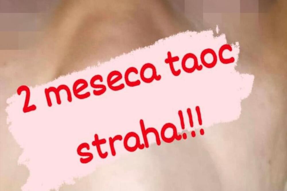 "Silovao me je 3 puta dnevno": Pevačicu pretukao dečko, ona oslepela zbog jačine udaraca! Slike su uznemirujuće