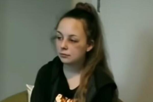 UDARALA SEBE ČEKIĆEM, GODINAMA OBMANJIVALA JAVNOST: Ono što je ova devojka radila će vas SLEDITI U SEKUNDI (VIDEO)