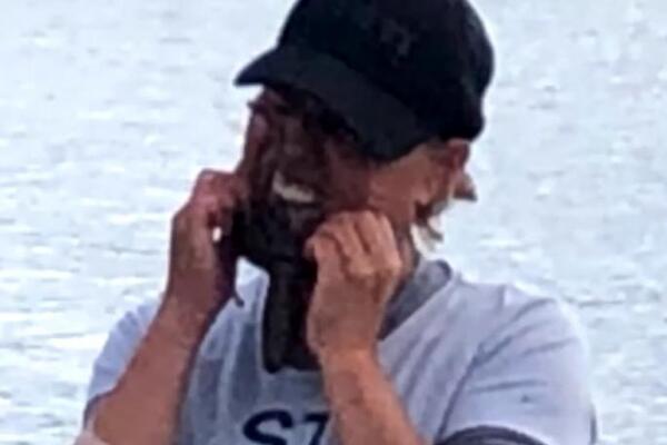 UZELA JE HOBOTNICU I STAVILA JE NA LICE: Posle par minuta završila u bolnici, EVO I ZAŠTO TAČNO, SVE JE SNIMLJENO