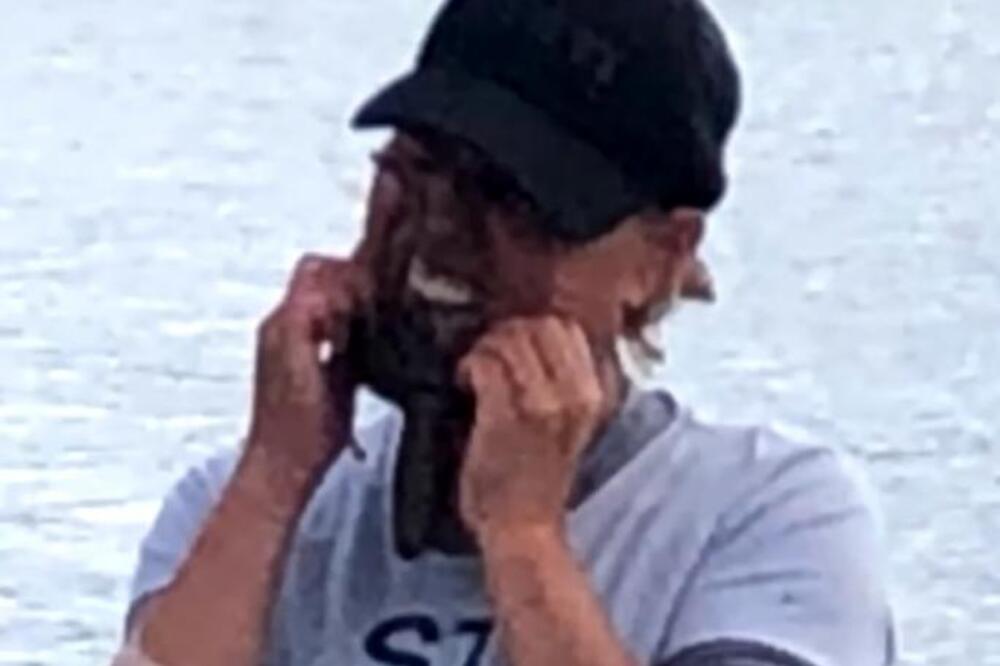 UZELA JE HOBOTNICU I STAVILA JE NA LICE: Posle par minuta završila u bolnici, EVO I ZAŠTO TAČNO, SVE JE SNIMLJENO