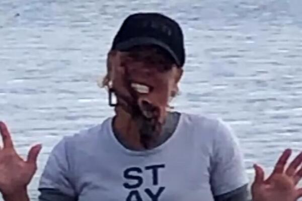 UZELA JE HOBOTNICU I STAVILA JE NA LICE MRTVA LADNA: Ono što je zatim usledilo, SLEDIĆE VAS U MESTU (VIDEO)