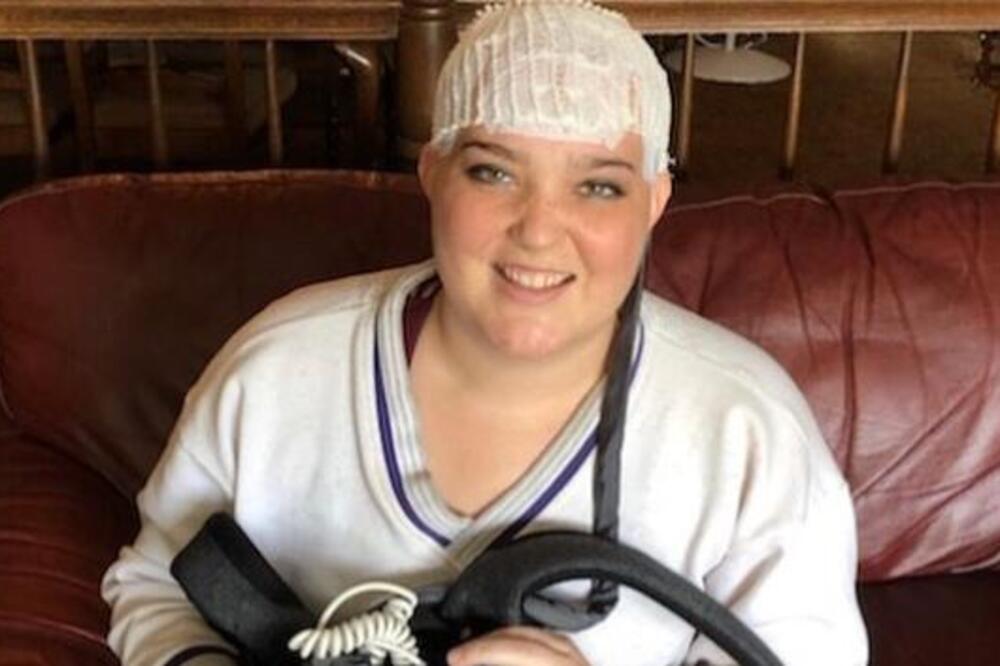 OVA ŽENA JE ZNALA DA IMA AGRESIVAN OBLIK RAKA NA MOZGU, A IMALA SAMO 1 SIMPTOM: Srbi će odmah kod DOKTORA kad čuju