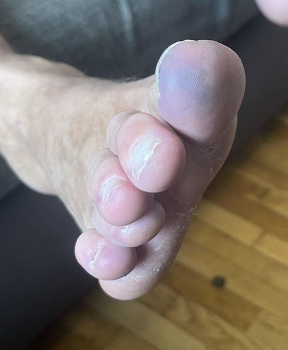 OVAKO SU OPLAVELI PRSTI MLADIĆ