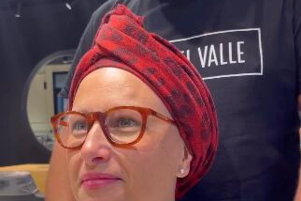 OVA ŽENA JE BILA ĆELAVA GODINAMA, A ONDA JE OTIŠLA KOD FRIZERA: Transformacija koju je napravio ostavila je U ŠOKU