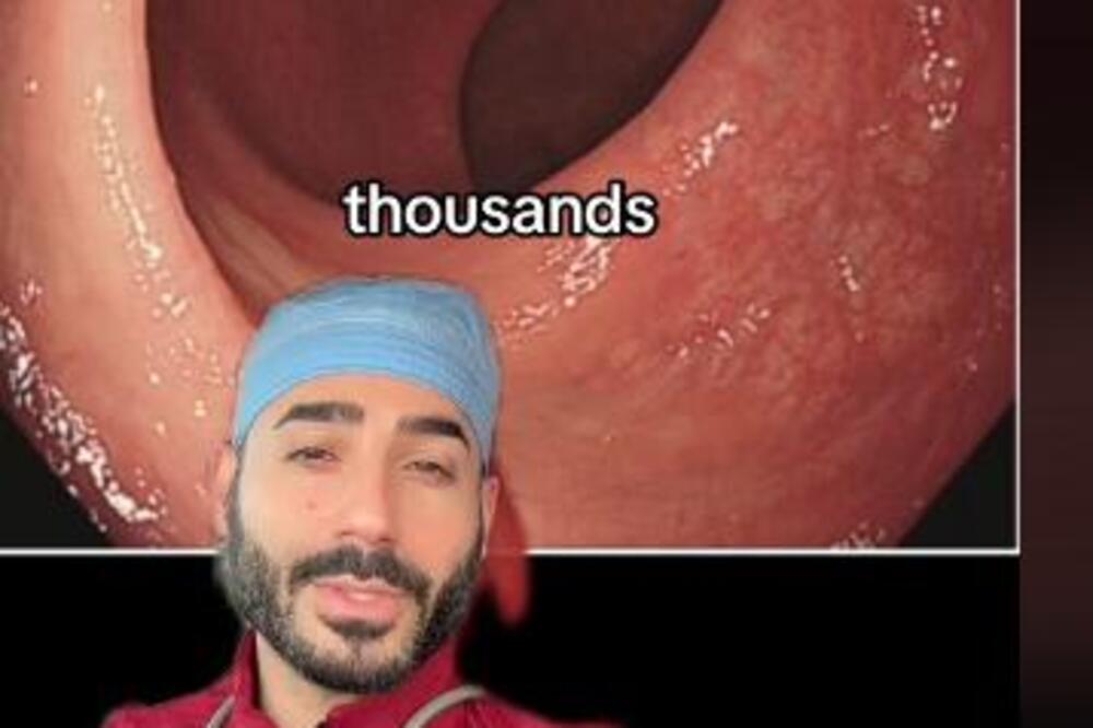 DOKTOR TVRDI DA OVAKO IZGLEDA BOLESNO DEBELO CREVO: Snimak ZGROZIO milione, ŽELUDAC ĆE VAM SE OKRENUTI U SEKUNDI