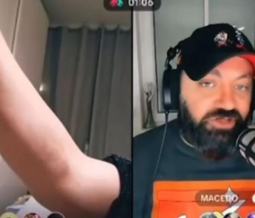 Miljana pokazala modricu koju joj je navodno napravio Zola