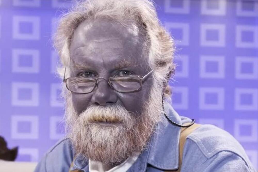 OVOG ČOVEKA SU ZBOG PLAVE KOŽE ZVALI VELIKI ŠTRUMF: Kada budete videli kako je DOBIO TU BOJU, ZANEMEĆETE u sekundi