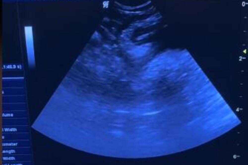 MAČKU SU ODVELI NA ULTRAZVUK PA SE SKAMENILI OD ŠOKA: Ono što je bilo u njenom STOMAKU prenerazilo je i VETERINARE