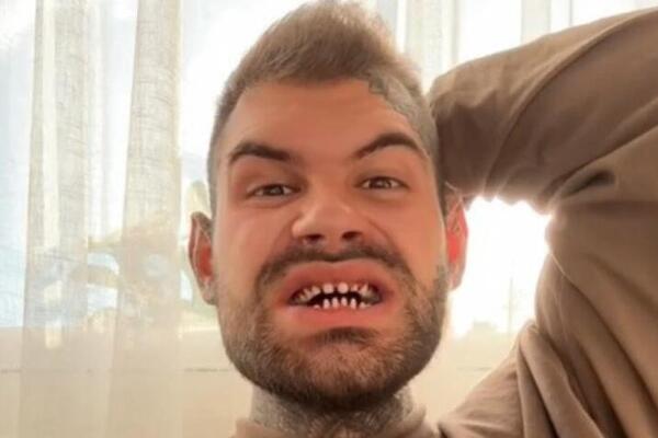 OTIŠAO JE U TURSKU PO BLISTAV OSMEH, A SAČEKALA GA JE PRAVA NOĆNA MORA: Dečko objasnio sve o OVOM ZAHVATU (VIDEO)