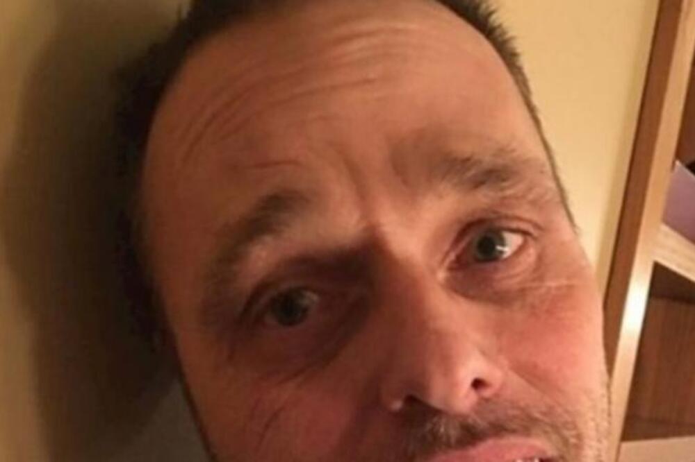 NARUČIO JE NAVLAKE ZA ZUBE PREKO INTERNETA: Kad ih je stavio i pogledao se u ogledalo, počeo je da plače (FOTO)