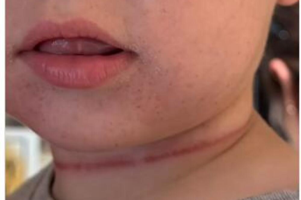 PROBUDILA SE I VIDELA DA JE DETETU KOSA OMOTANA OKO VRATA: Izgubio SVEST prestao da DIŠE a njegov VRAT JE BIO KAO..