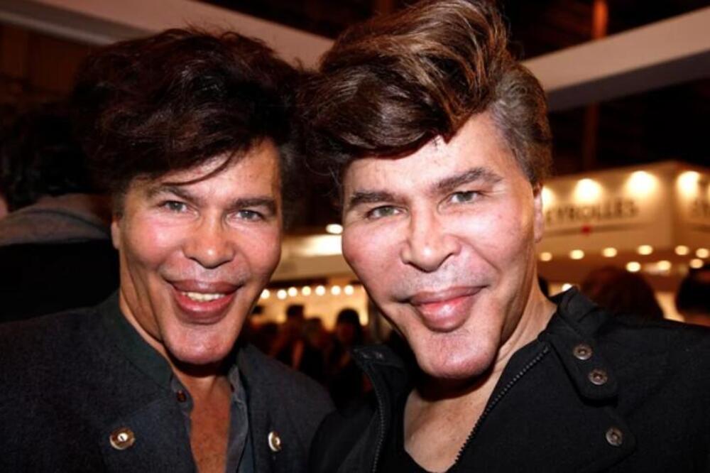 BLIZANCI SE OPERISALI DO NEPREPOZNATLJIVOSTI I UMRLI U RAZMAKU OD 6 DANA: Pre PLASTIKE su bili SINONIM za lepotu