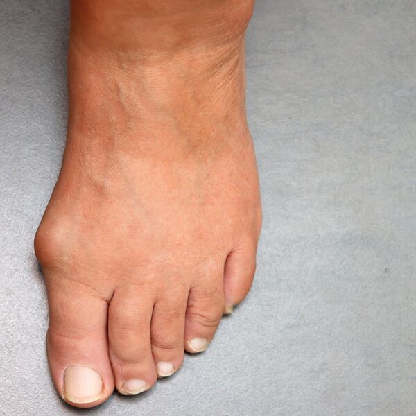 Da li vas često svrbi levi taban? Evo šta kaže verovanje, nesreća vam dolazi samo u jednom slučaju