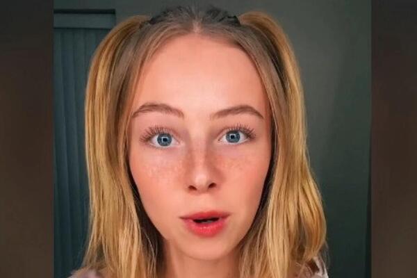 NIJE PRALA KOSU OSAM MESECI: Ljudi se FRAPIRAJU kada vide kako izgleda (VIDEO)