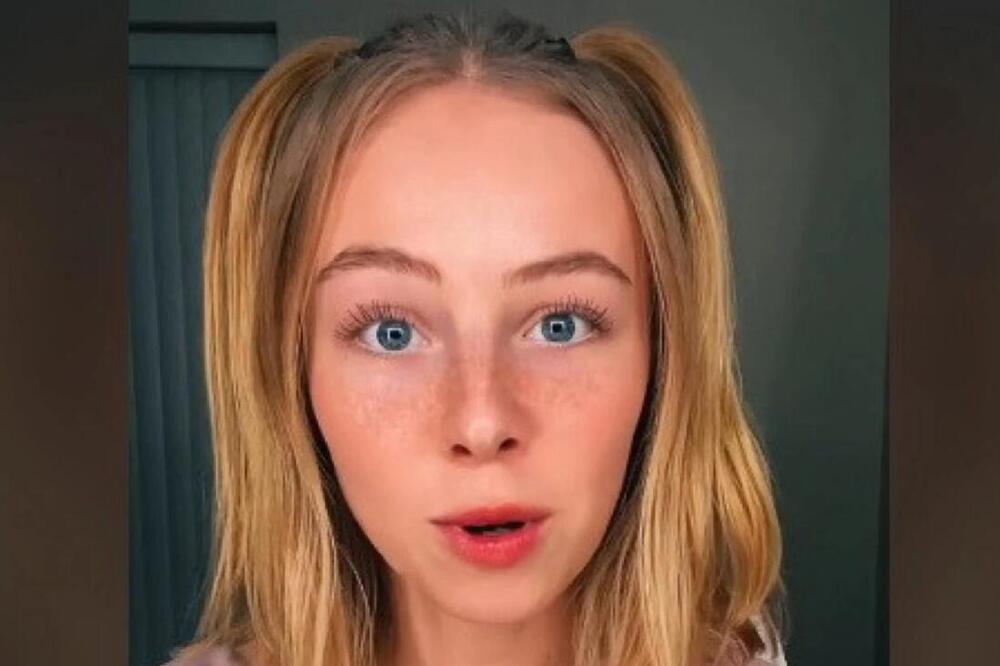 NIJE PRALA KOSU OSAM MESECI: Ljudi se FRAPIRAJU kada vide kako izgleda (VIDEO)